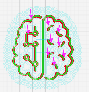 Cerveau3dblocs.png