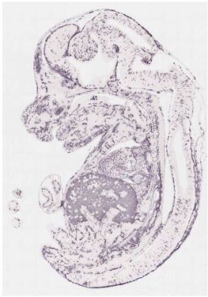 Hemoglo-b-expression.jpg